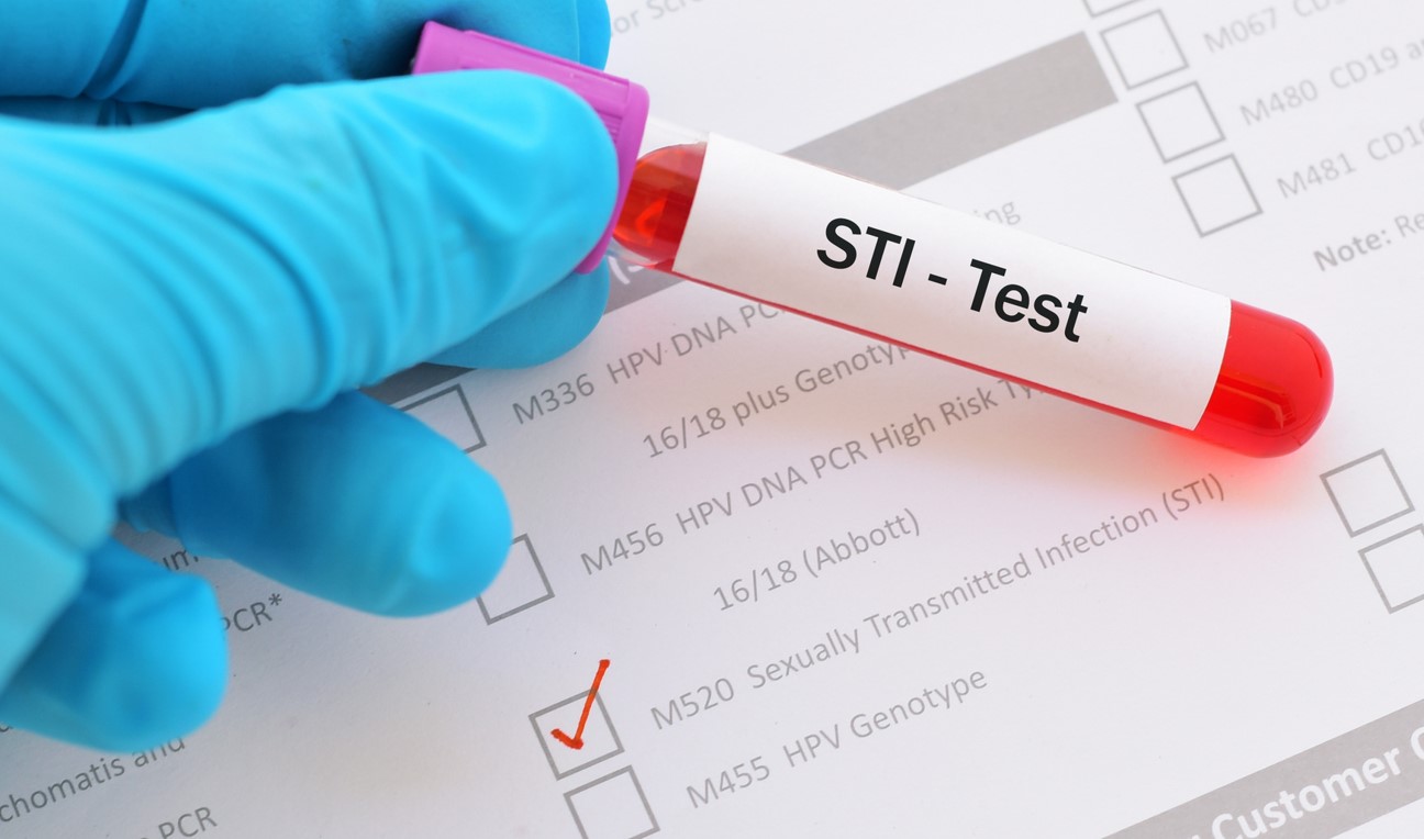 Photo of a blood test with the label STI test