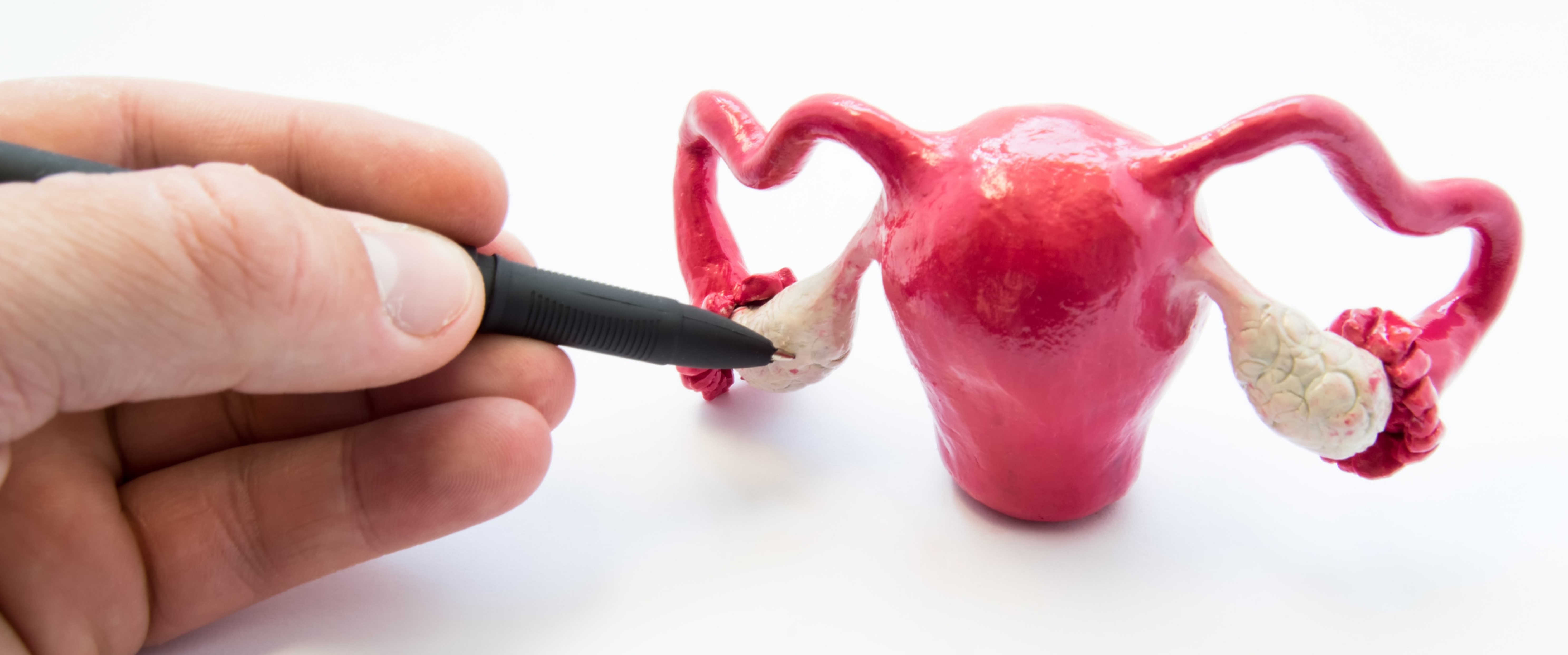 Photo of a pen pointing to an ovary on a model uterus