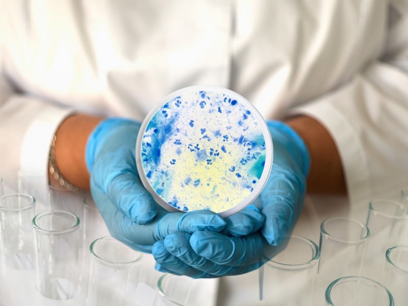 Scientist in lab coat holding a petri dish of chlamydia 