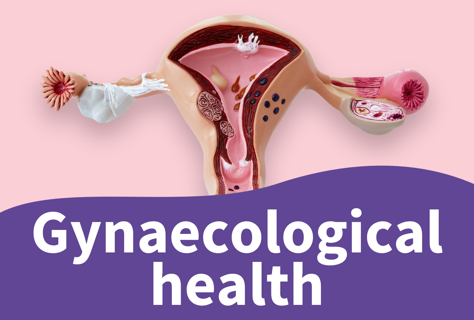 Gynaecological health